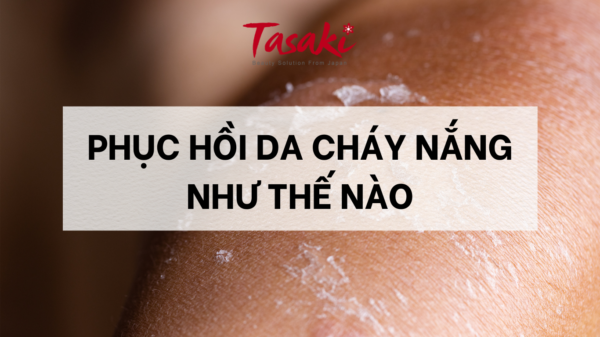 Phục hồi da cháy nắng